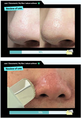 ilso | Super Melting Sebum Softener 150mL
