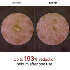 Dr.Melaxin | Peel Shot Exfoliant White Rice Ampoule 80ml