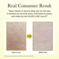 Arencia | Vitamin C Booster Shot 30ml