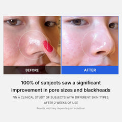 Medicube | Zero Pore Pads 2.0 70 Pads