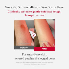Medicube | Red Acne Body Peeling Shot 110g