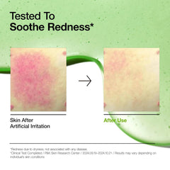 ANUA | Azelaic Acid 10 Hyaluron Redness Soothing Serum 30ml