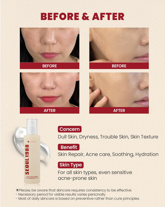 KSECRET | SEOUL1988 Essence Snail Mucin 97% + Rice 100ml